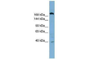 WB Suggested Anti-ABCC11 Antibody Titration:  0. (ABCC11 anticorps  (Middle Region))