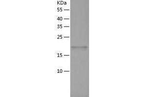 Western Blotting (WB) image for rho Guanine Nucleotide Exchange Factor (GEF) 7 (ARHGEF7) (AA 264-450) protein (His-IF2DI Tag) (ABIN7124865)