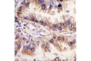 Image no. 3 for anti-serine threonine Kinase 39 (STK39) (C-Term) antibody (ABIN356942)