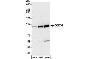 anti-Coronin 7 (CORO7) (AA 400-450) antibody
