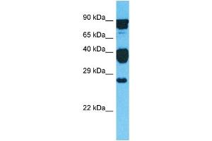 Western Blotting (WB) image for anti-GLI Pathogenesis-Related 1 Like 2 (GLIPR1L2) (C-Term) antibody (ABIN2791969) (GLIPR1L2 anticorps  (C-Term))