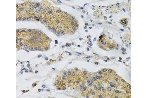 Immunohistochemistry of paraffin-embedded Human stomach using PTPRA Polyclonal Antibody at dilution of 1:100 (40x lens).