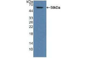 Detection of Recombinant ALDH1A1, Human using Polyclonal Antibody to Aldehyde Dehydrogenase 1 Family, Member A1 (ALDH1A1)