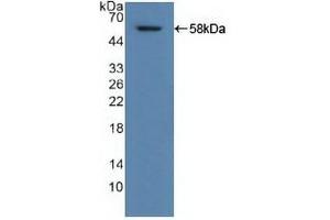 Detection of Recombinant ALDH1A1, Human using Polyclonal Antibody to Aldehyde Dehydrogenase 1 Family, Member A1 (ALDH1A1) (ALDH1A1 anticorps  (AA 2-501))