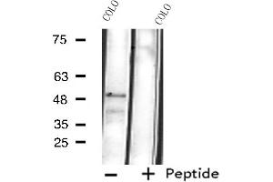 Western blot analysis of extracts from COLO cells, using Cytochrome P450 4B1 antibody. (CYP4B1 anticorps  (Internal Region))