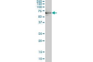 HSPA1B monoclonal antibody (M02), clone 3B7 Western Blot analysis of HSPA1B expression in IMR-32 .