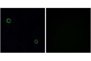 Immunofluorescence analysis of A549 cells, using CXCR4 Antibody. (CXCR4 anticorps  (AA 300-349))