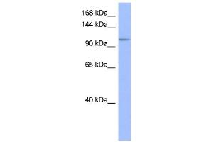 WB Suggested Anti-MSH4 Antibody Titration:  0. (MSH4 anticorps  (Middle Region))