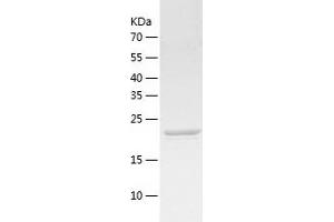 Western Blotting (WB) image for ATP-Binding Cassette, Sub-Family B (MDR/TAP), Member 6 (ABCB6) (AA 598-818) protein (His-IF2DI Tag) (ABIN7121931)