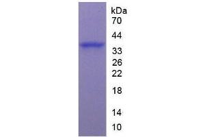 Image no. 1 for Arginase (ARG) (AA 1-322) (Active) protein (His tag) (ABIN6239895) (ARG Protein (AA 1-322) (His tag))