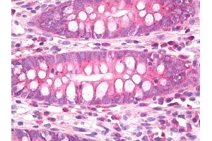 Anti-CB1 antibody IHC of human colon. (CNR1 anticorps)