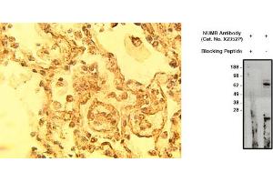Image no. 1 for anti-Numb Homolog (NUMB) antibody (ABIN793714) (NUMB anticorps)