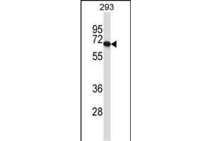 PDILT anticorps  (AA 345-374)