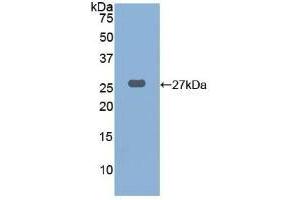 Detection of Recombinant CTSK, Human using Polyclonal Antibody to Cathepsin K (CTSK) (Cathepsin K anticorps  (AA 115-329))