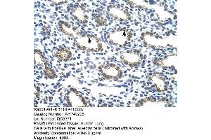 Rabbit Anti-KRT18 Antibody  Paraffin Embedded Tissue: Human Lung Cellular Data: Alveolar cells Antibody Concentration: 4. (Cytokeratin 18 anticorps  (C-Term))