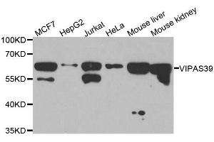 Western blot analysis of extracts of various cell lines, using VIPAS39 antibody. (VIPAR anticorps  (AA 1-220))