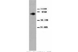 Image no. 2 for anti-Protein Kinase C, alpha (PKCa) (C-Term) antibody (ABIN1492930) (PKC alpha anticorps  (C-Term))