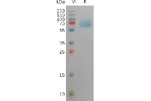 Human F Protein, His Tag on SDS-PAGE under reducing condition.