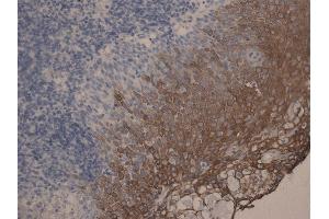 Immunohistochemistry staining of tonsil (paraffin-embedded sections) with anti-Cytokeratin 10+13, (DE-K13). (Keratin 10/13 anticorps)