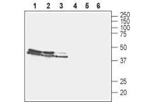 Western blot analysis of rat brain membranes (lanes 1 and 4), mouse brain membranes (lanes 2 and 5) and human SH-SY5Y neuroblastoma cell lysate (lanes 3 and 6):1-3.