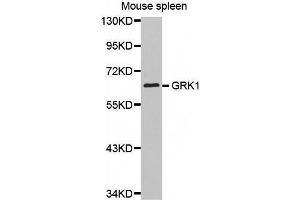 Western Blotting (WB) image for anti-G Protein-Coupled Receptor Kinase 1 (GRK1) (AA 1-160) antibody (ABIN3023688) (GRK1 anticorps  (AA 1-160))