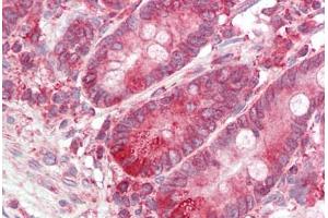 Image no. 2 for anti-B-Cell Receptor-Associated Protein 31 (BCAP31) (C-Term) antibody (ABIN6749735) (BCAP31 anticorps  (C-Term))