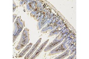 IHC analysis of COPE using anti-COPE antibody (ABIN7602509). (COPE anticorps  (AA 80-308))