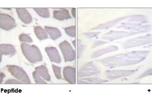 Immunohistochemical analysis of paraffin-embedded human skeletal muscle tissue using ATF1 polyclonal antibody .