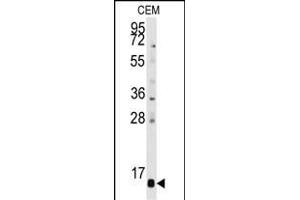 PFDN6 anticorps  (N-Term)