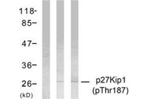 Western blot analysis of extracts from HeLa cells treated with EGF or IFN-alpha, using p27 Kip1 (Phospho-Thr187) Antibody. (CDKN1B anticorps  (pThr187))