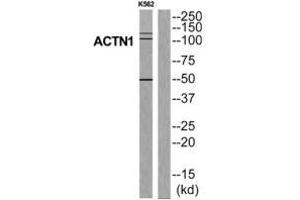Western blot analysis of extracts from K562 cells, using ACTN1 antibody. (ACTN1 anticorps  (N-Term))