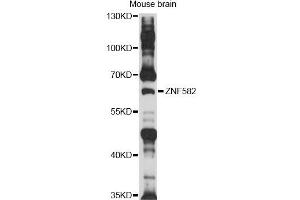 Western blot analysis of extracts of mouse brain, using ZNF582 antibody (ABIN6292528) at 1:1000 dilution. (ZNF582 anticorps)