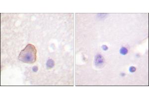 Immunohistochemical analysis of paraffin-embedded human brain tissue using ADD1 (Ab-726) antibody. (alpha Adducin anticorps)