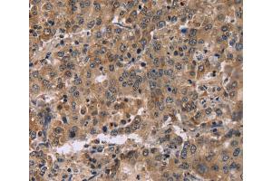 Immunohistochemistry (IHC) image for anti-Family with Sequence Similarity 107, Member A (FAM107A) antibody (ABIN5544390) (FAM107A anticorps)