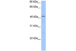 WB Suggested Anti-HMBS Antibody Titration: 0. (HMBS anticorps  (Middle Region))