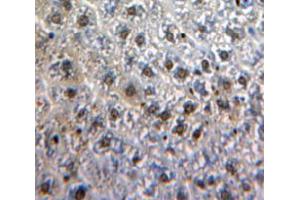 Used in DAB staining on fromalin fixed paraffin-embedded Liver tissue
