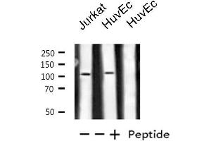 Western blot analysis of extracts from Jurkat/HuvEc cells, using PKN1/PRK1 antibody. (PKN1 anticorps  (Internal Region))