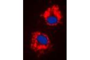 Immunofluorescent analysis of Cytochrome P450 1A1/2 staining in HeLa cells. (CYP1A1/2 anticorps  (Center))