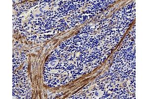 Immunohistochemistry analysis of paraffin-embedded rat spleen using LDLR Polyclonal Antibody at dilution of 1:300. (LDLR anticorps)