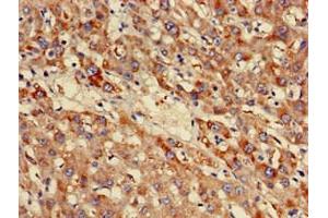 Immunohistochemistry of paraffin-embedded human liver tissue using ABIN7160920 at dilution of 1:100 (NDUFB3 anticorps  (AA 2-65))