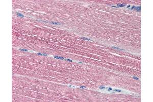 Anti-Acetylcholinesterase antibody IHC of human skeletal muscle. (Acetylcholinesterase anticorps  (N-Term))