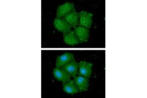 ICC/IF analysis of HSPA13 in Hep3B cells.