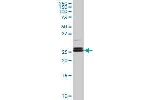 PAFAH1B3 monoclonal antibody (M08), clone 3G6.