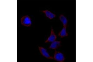 Immunofluorescence analysis of POU5F1 polyclonal antibody  in HeLa cells. (OCT4 anticorps  (Glu125))