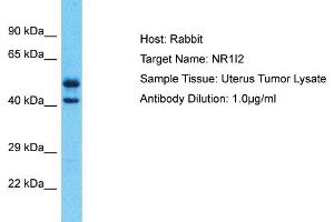 Host: Rabbit Target Name: NR1I2 Sample Type: Uterus Tumor lysates Antibody Dilution: 1.