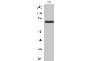 Western Blotting (WB) image for anti-V-Raf-1 Murine Leukemia Viral Oncogene Homolog 1 (RAF1) (Thr58) antibody (ABIN3186672) (RAF1 anticorps  (Thr58))