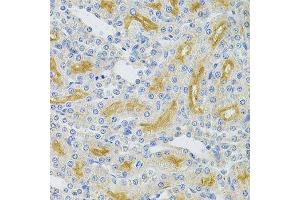 Immunohistochemistry of paraffin-embedded rat kidney using UBE2B Antibody.