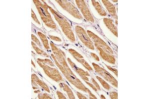 (ABIN6242156 and ABIN6578282) staining Zebrafish ak2 in human heart tissue sections by Immunohistochemistry (IHC-P - paraformaldehyde-fixed, paraffin-embedded sections).