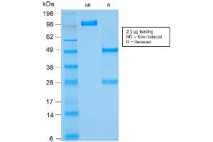 SDS-PAGE Analysis of Purified BCL2 Mouse Recombinant Monoclonal Antibody ABIN6383839. (Recombinant Bcl-2 anticorps)