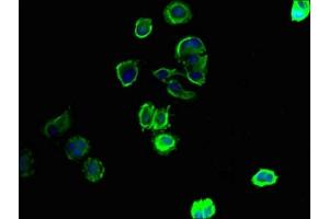 Immunofluorescent analysis of MCF-7 cells using ABIN7170255 at dilution of 1:100 and Alexa Fluor 488-congugated AffiniPure Goat Anti-Rabbit IgG(H+L)